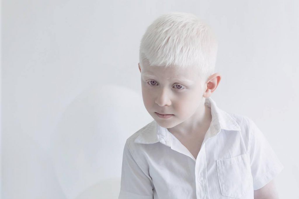 Albino People's Beauty Photos by Yulia Taits.