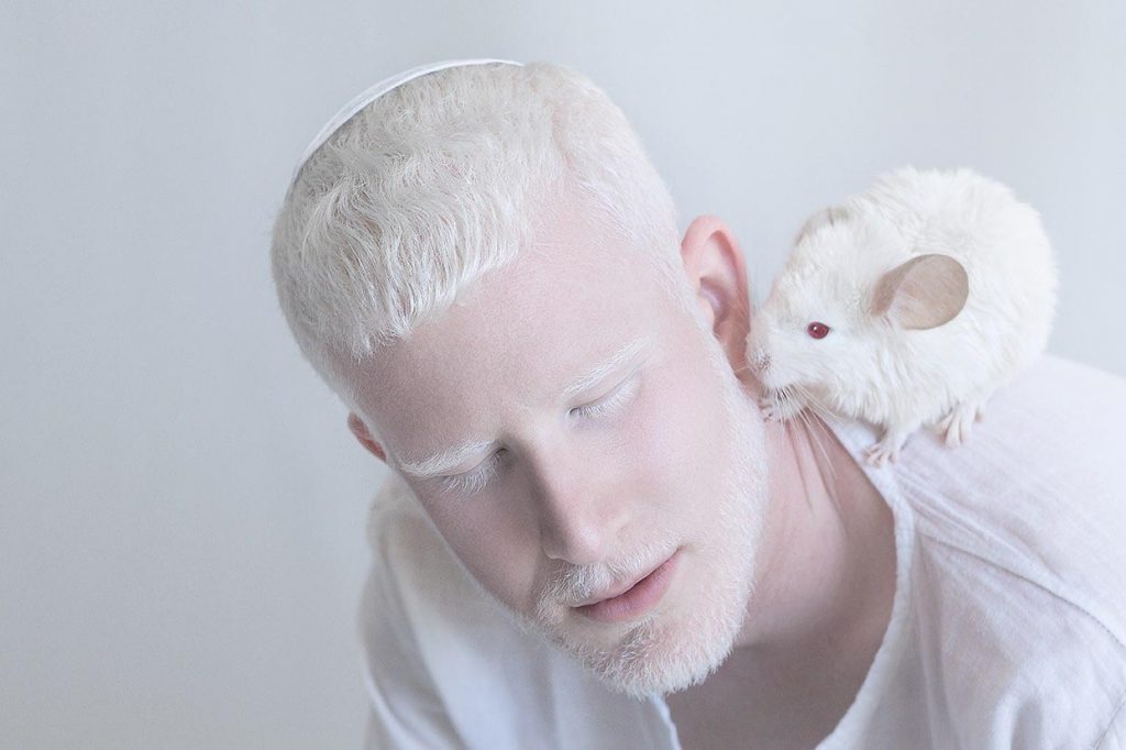 Albino People's Beauty Photos by Yulia Taits.